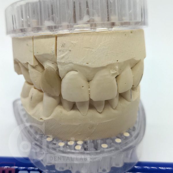 Demonstration Model: PFM Crown