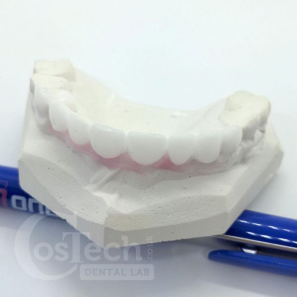 Demonstration Model: Diagnostic Waxup