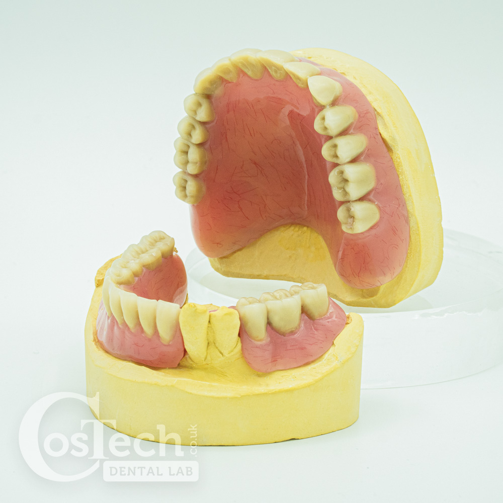 Demo Model - Upper & Lower Dentures