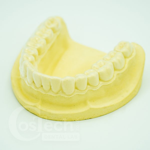 Demo Model - Lower Whitening Tray