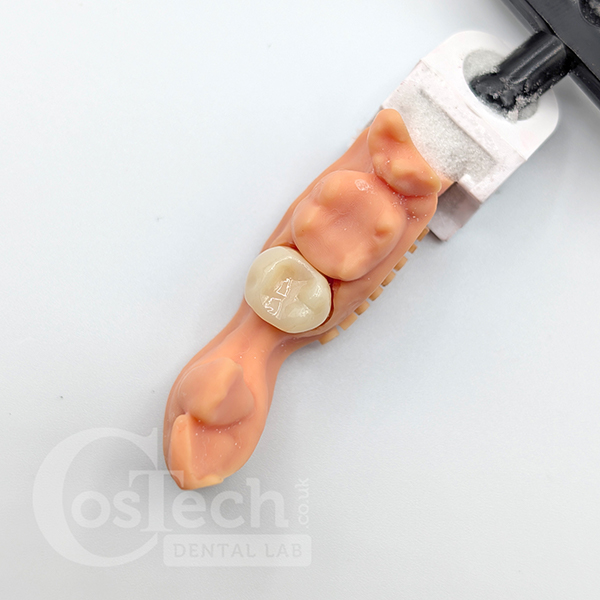 Demonstration Model: Economy Monolith Zirconia Crown - Image 5