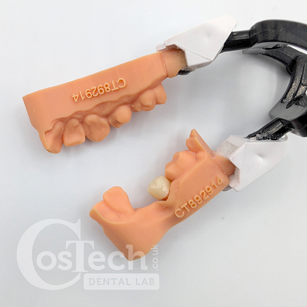 Demonstration Model: Economy Monolith Zirconia Crown - Image 3