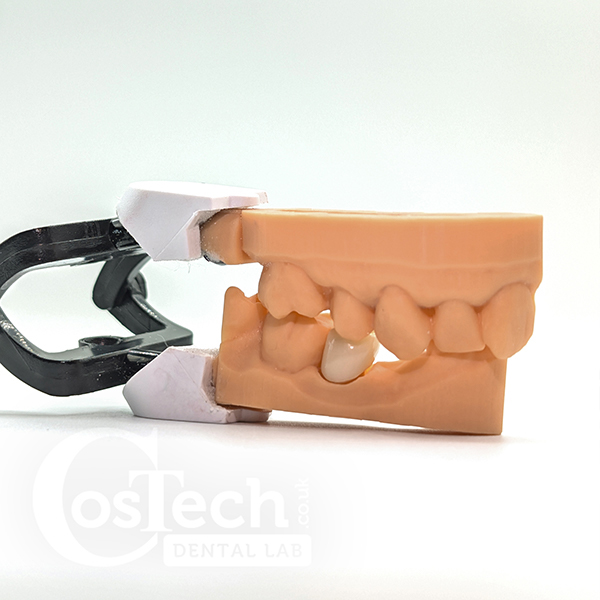 Demonstration Model: Economy Monolith Zirconia Crown