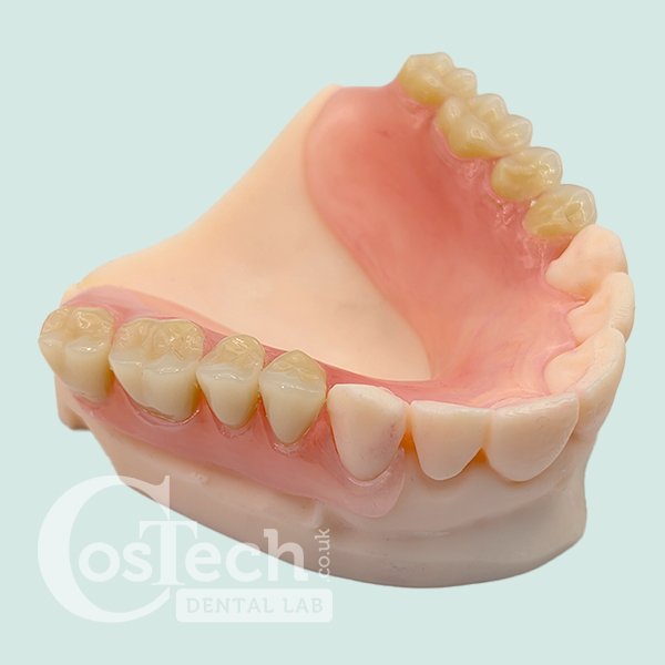 Demo Model – Flexible Partial Denture - Image 3